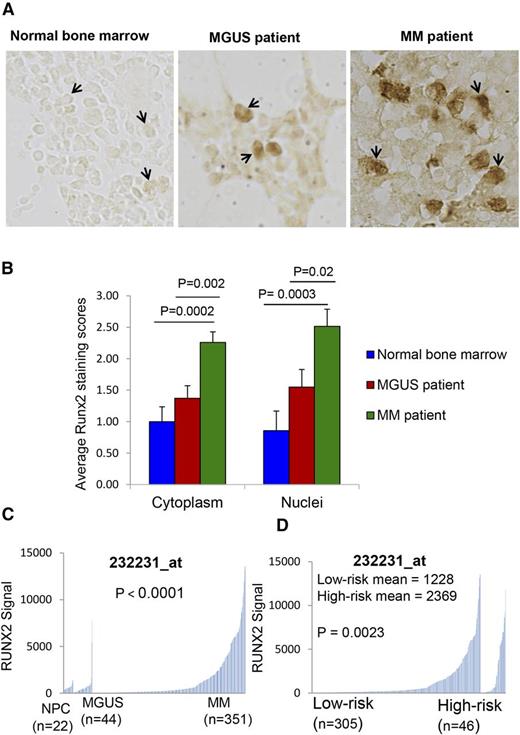 Figure 7. Runx2 expression in plasma cells of normal bone marrow donors, MGUS, and MM patients. (A) Runx2 staining of plasma cells in normal bone marrow, MGUS, and MM patient biopsies. Strong Runx2 expression (brown color) was seen in the nuclei and cytoplasm of MM cells, whereas light staining was found in plasma cells of normal bone marrow donors and MGUS patients as indicated by arrows (original magnification, ×400). Not all positively stained cells are shown. (B) Runx2 staining density in cytoplasm and nuclei of plasma cells in normal (blue bars), MGUS (red bars), and MM patient (green bars) groups. Error bars represent mean ± SEM. Significant differences between groups are indicated by P value. (C) Runx2 mRNA expression was measured by gene microarray and compared between normal (NPC), MGUS, and MM patient groups. The number of patients in each group (n) is shown. (D) Runx2 expression was compared between low-risk and high-risk MM patients by gene expression profiling (GEP). The number of patients in each group (n) is shown. Significant differences between groups are indicated by P value.