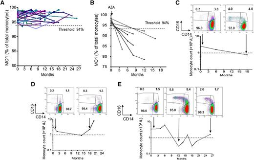 Figure 4. Monocyte subset profile as a biomarker of disease evolution. (A) Repeated evaluation of MO1 fraction in 21 untreated CMML patients followed from 6 to 26 months. (B) Evaluation of MO1 fraction in 7 CMML patients before and after treatment with azacytidine (AZA); all 7 patients responded to treatment.11 (C-E) Evolution of monocyte subset repartition and monocyte count in CMML patients during treatment with a demethylating agent. (C) Patient who responded to azacytidine. (D) Patient who only transiently responded to azacytidine. (E) Patient who relapsed after initial response.