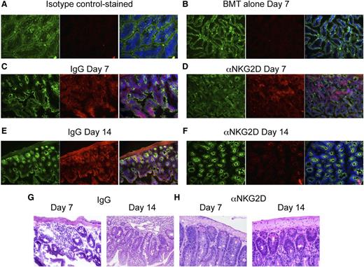 Figure 6. RAE-1 is persistently induced on colonic epithelial cells in GVHD-inflicted mice treated with isotype control but not anti-NKG2D antibody. Irradiated Balb/c mice were transplanted with B6-derived BM alone or with B6-derived BM cells and FACS-sorted CD8+ T cells. The mice were treated 3 times per week with either isotype control antibody (IgG) or anti-NKG2D antibody. Frozen sections of colonic tissue were obtained from the mice at the indicated time points. Tissues were stained with fluorochrome-labeled Pan Keratin antibody and DAPI, and with (A) fluorochrome-labeled secondary antibody only or with RAE-1/secondary antibody in (B) TCD BM–alone mice on day 7, (C) IgG-treated mice on day 7, (D) anti-NKG2D antibody-treated mice on day 7, (E) IgG-treated mice on day 14, and (F) anti-NKG2D antibody-treated mice on day 14. Panels from left to right represent images showing fluorescence with Pan Keratin alone, RAE-1 alone, and RAE-1/Pan Keratin/DAPI. Pan Keratin is shown as green, RAE-1 as red, and DAPI as blue. (G) Sections from paraffin-embedded colons obtained on days 7 and 14 post-BMT were stained with hematoxylin and eosin from mice treated with IgG or (H) anti-NKG2D antibody. One representative of 3 independent experiments is shown.