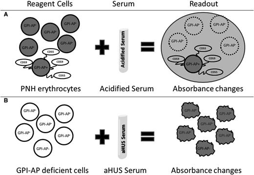Figure 6. Model of Ham test for PNH and modified Ham test for aHUS diagnosis. The Ham test evaluates the effect of acidified serum on patient's cells (A), whereas the modified test evaluates the effect of patient's serum on GPI-AP–deficient reagent cells (B). Both tests use absorbance changes as readouts of cell viability.