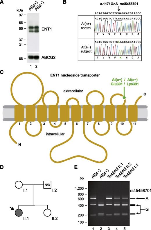 Figure 2. Homozygosity for the p.Glu391Lys variation in the ENT1 nucleoside transporter is responsible for the At(a−) blood type in people of African ancestry. (A) Western blot analysis of ENT1 (performed as in Figure 1D) in an At(a−) subject and an At(a+) control, showing the presence of ENT1 in individuals with the At(a−) blood type. (B) Detail of SLC29A1 sequencing in an At(a−) subject and an At(a+) control, showing the homozygosity for the A allele of rs45458701 in individuals with the At(a−) blood type. Reference sequence (NC_000006) is indicated at the top, and the Taqα1 restriction site that is absent in the A allele but present in the G allele is underlined. (C) Topology diagram of the human ENT1 nucleoside transporter (adapted from Sundaram et al18) highlighting the location of the p.Glu391Lys variation encoded by the A allele of rs45458701; transmembrane domains are numbered 1 to 11. (D) Pedigree of the family of an At(a−) patient (arrow); gray- and white-filled symbols represent individuals with the At(a−) and At(a+) blood types, respectively; N/D, no data. (E) Polymerase chain reaction-restriction fragment length polymorphism analysis of rs45458701 in At(a−) and At(a+) controls (lanes 1 and 2) and in the family depicted in D (lanes 3-5).