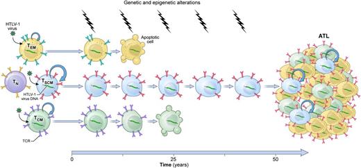A model of HTLV-1–induced leukemogenesis. Longitudinal accumulation of genetic and epigenetic abnormalities in long-lived HTLV-1–infected TSCM cells leads to the development of ATL. TN, naïve T cells; TCR, T-cell receptor.
