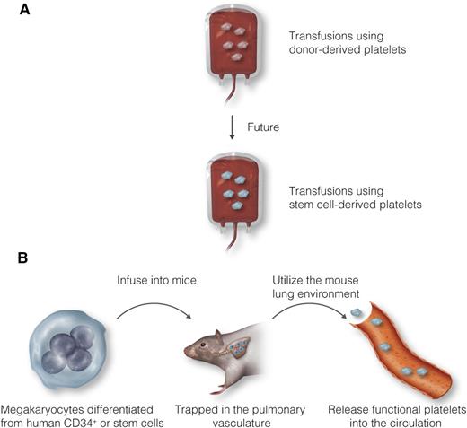 Future of platelet transfusion therapy. (A) Because of numerous concerns about donor-derived platelets, stem cell–derived platelets may be a potential source for transfusion. (B) Instead of generating platelets from human embryonic or induced pluripotent stem cells ex vivo, Wang et al demonstrated that ex vivo–derived human megakaryocytes infused into mice can release functional platelets into the circulation. Professional illustration by Luk Cox, Somersault18:24.