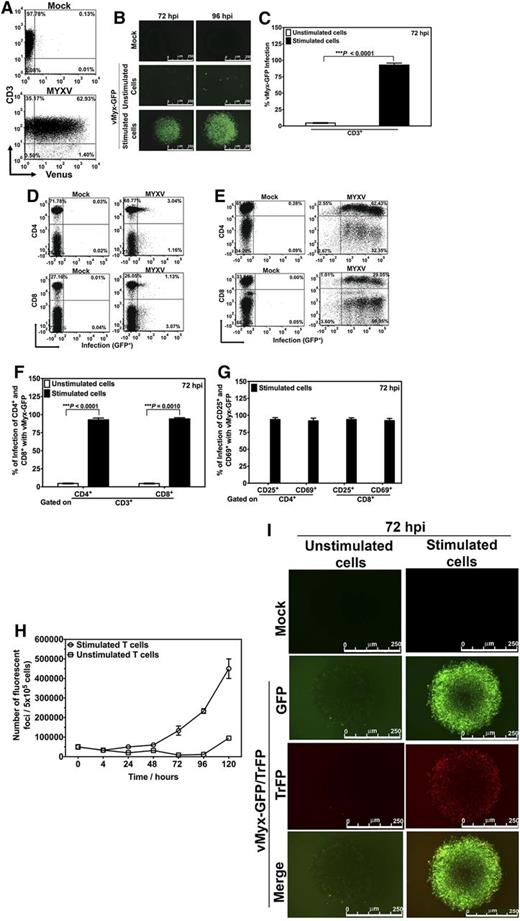 Figure 1. MYXV binds to unstimulated human T lymphocytes but activation of human T lymphocytes is required for MYXV replication. (A) To investigate whether MYXV binds to unstimulated human T lymphocytes, T cells were isolated using an EasySep negative selection HLA T cell enrichment kit (up to >95% purity). Approximately 1 × 106 of these negatively isolated T lymphocytes were incubated with recombinant vMyx-Venus/M093L at an MOI of 10 for 1 hour on ice to allow virus binding but not entry. After this, unbound virus was washed twice with cold 1× PBS + 5% FBS. T cells were then stained with anti-CD3 antibody, and the levels of Venus+ labeling in the CD3+ population were determined by flow cytometry (bottom panel). A representative experiment from 1 donor is shown. To investigate virus infection, ∼3-4 × 106 isolated human T lymphocytes were incubated with recombinant vMyx-GFP at an MOI of 10 for 1 hour at room temperature to allow virus adsorption. After this, mock-treated and infected T cells were stimulated with anti-CD3/CD28 beads at a cell:bead ratio of 1:1. This was followed by incubation at 37°C for 72 hours or 96 hours. The unstimulated (ie, without adding beads) mock- and MYXV-treated T lymphocytes were subjected to the same culturing conditions. (B) Seventy-two and 96 hours after culturing, expression of virus-expressed GFP was monitored using fluorescence microscopy. (C-F) To quantify the levels of infection of different T populations, 72 hours after vMyx-GFP exposure, cells were stained with antibodies against CD3, CD4, and CD8, and the levels of GFP+ in each population were quantified by using flow cytometry. Likewise, in panel G, levels of infection of T lymphocyte activation proteins CD25 and CD69 were also quantified using flow cytometry. Data reported are representative of al least 6 independent experiments. Significance (ie, P < .05) was determined using the Student t test. To investigate whether MYXV launches productive virus replication in stimulated human T lymphocytes, we performed 1-step growth curves. (H) T cells were infected with vMyx-GFP at an MOI of 10. Infected/unstimulated T cells, and infected/stimulated T cells, were harvested, cells were lysed using repeated freeze-thaw, and the amount of infectious virus in each sample was quantified using foci formation on BSC40 cells. (I) Stimulated or unstimulated T cells were infected with recombinant vMyx-GFP/TrFP at an MOI of 10. Expression of GFP (expressed at both early and late times postinfection) and TrFP (expressed only at late stages of virus infection) was determined 72 hours after infection using fluorescence microscopy. FBS, fetal bovine serum; PBS, phosphate-buffered saline.
