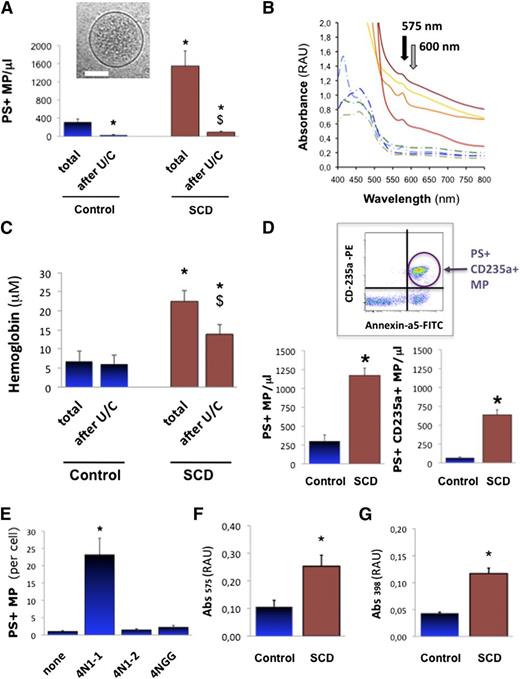 Figure 1. Heme-MP association in SCD plasma. Circulating PS+ MPs (A) were quantified in platelet-free plasma (PFP) from steady-state SCD patients (n = 47) or control matched healthy volunteers (n = 22) by fluorescence-activated cell sorter (FACS) after annexin-a5 labeling, as well as plasma Hb by spectrophotometry (Abs575-Abs600), before and after MP depletion by ultracentrifugation (U/C). (B) Whole spectrum analysis of light absorbance in SCD (full lines) and control PFP (dotted lines). Black arrow marks peak of Hb absorbance at 575 nm; gray arrow points at 600 nm. (C) Absorbance (Abs575-Abs600) in PFP from control volunteers and steady-state SCD patients. *P < .01 vs total in controls; $P < .05 vs total in SCD. (D) Circulating erythrocyte MPs were quantified in plasma from control and SCD patients (n = 12) by FACS after phycoerythrin-conjugated anti-CD235a+ immunoglobulin G (IgG) labeling; *P = .01. We generated stocks of MPs shed by purified erythrocytes in vitro. SCD and control erythrocytes were incubated in vitro with CD47 agonist peptide 4N1-1, truncated 4N1-2, or mutated 4NGG peptide (25 μM, 30 minutes). (E) Quantification of MPs released by control erythrocytes, by FACS after annexin-a5 labeling. Supernatants were ultracentrifuged to pellet MPs, which were resuspended at similar concentrations in PBS (500 MPs/μ). Spectrophotometric measurements relative to Hb (Abs575) (F) and heme (Abs398) (G) were gathered. *P < .05 vs control MPs.