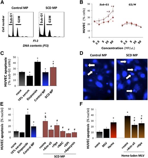 Figure 4. Endothelial apoptosis by heme-laden MPs. Confluent HUVEC monolayers were treated with purified erythrocyte MPs (25 MPs/μL), synthetic heme-laden MLVs, or heme alone (5 μM) for 16 hours. Some MPs were preincubated with annexin-a5 (10 μg/mL) or Hpx (2 μM) for 1 hour. HUVECs were then fixed. Total DNA contents were determined by FACS after coloration with propidium iodide. Cells undergoing apoptosis (sub-G1 phase) or proliferation (G2/M) were quantified. (A) Representative DNA content profiles. We compared the effects of serial dilutions of control and SCD erythrocyte MPs (B) vs high serum (10% serum) or proapoptotic etoposide (100 μM). Triangles, SCD MPs; squares, control MPs. *P < .05 vs none; #P < .05 vs control MPs. (C) In other experiments, HUVECs were fixed in situ and stained with 4,6-diamidino-2-phenylindole. Nuclei displaying fragmentation, pyknosis, or condensed chromatin by fluorescence microscopy were counted as apoptotic and expressed as percentage. (D) Representative images (×400). Arrows designate fragmented and condensed nuclei. (E) Quantification of degraded nuclei after incubation with erythrocyte MPs (25 MPs/μL), vs high serum (10% serum), or proapoptotic etoposide. Some HUVECs were preincubated for 30 minutes with NAC (5 mM), DPI (10 μM), or apocynin (100 μM). *P < .05 vs none; $P < .05 vs control MPs; #P < .05 vs SCD MPs. (F) Effects of synthetic heme-laden MLVs preincubated with annexin-a5 or Hpx. *P < .05 vs none; #P < .05 vs SCD MPs.
