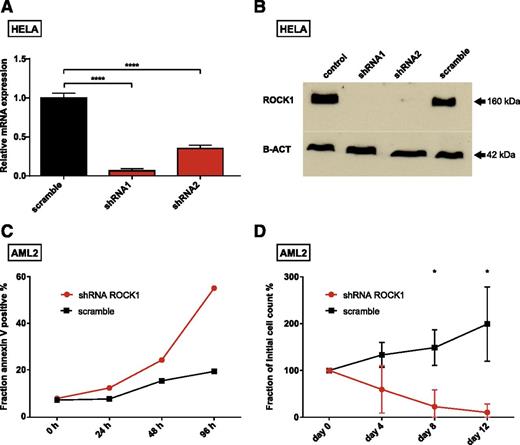 Figure 2. Consequences of ROCK1 knockdown. Knockdown levels of 2 shRNAs targeting ROCK1 are presented for messenger RNA (mRNA) (A) and protein (B). (C) Fraction of apoptotic cells after ROCK1 knockdown (red) and a nontarget control shRNA (scramble, black) at indicated time points. (D) Percentage of initial cell counts after transduction of cells with shRNAs targeting ROCK1 (red) and a nontarget control (black) at indicated time points. Due to the limited amount of primary cells available, the experiments shown in panels A and B were done with HeLa cells, whereas primary AML cells from our donor (AML2) were used in the experiments depicted in panels C and D. The cell source is indicated at the top of each panel. The means and standard deviations of experiments done in triplicates are given in panels A and D; significance was assessed by means of Student t test; *P < .05, ****P < .0001.