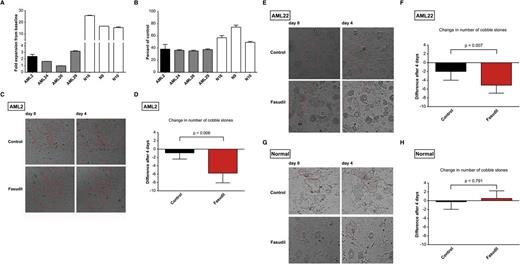 Figure 3. Effect of the ROCK inhibitor fasudil on malignant and nonmalignant hematopoietic cells. (A) Proliferation kinetics of untreated cells from the indicated donors over 96 hours of suspension culture (fold expansion from baseline to the end of the suspension-culture period is given). To allow for the cross-donor comparisons (B), all results obtained after 96 hours of fasudil treatment (40 μM), were normalized to wells containing vehicle-treated cells of each respective donor. The index patient AML2 (black) is shown in comparison with 3 other AML donors (AML24, AML26, and AML29; gray) and 3 normal donors (N16, N9, and N10; white). Means and standard deviations of experiments done in triplicate are presented. (C-H) Results of experiments done with leukemic and nonmalignant hematopoietic progenitors in LTC-IC. Representative microscopic images before (day 0) and after 4 days of treatment with carrier (control) or active drug (fasudil) at 40 μM concentration are shown for AML2 (C), AML22 (E), and normal CD34+ HSPCs isolated from volunteer donors (G). Red lines highlight cobblestone areas. Note the disappearance of cobblestone cells in the fasudil-treated sample in the AML cells but not in normal HSPCs. All images were taken using the Celigo cytometer according to the manufacturer’s instructions; native live cell imaging. Quantification of the changes of cobblestone numbers after 4 days of treatment with fasudil or carrier (control) in AML2 (D), AML22 (F), and normal CD34+ HSPCs (H). Means and standard deviations of 4 to 8 replicates are shown. All cobblestones present within each well were counted.