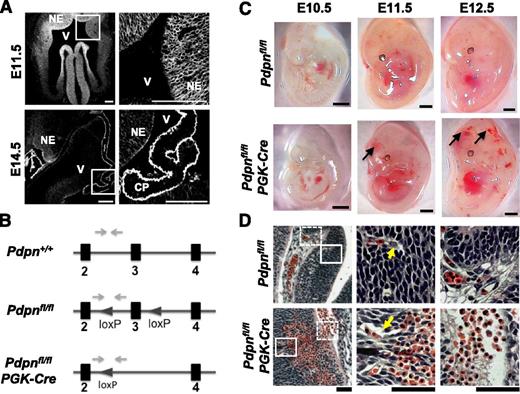 Figure 1. Podoplanin is expressed throughout the neural tube in development and its loss results in hemorrhaging. (A) Immunostaining shows podoplanin in the neuro-epithelium on frozen sections of wild-type embryonic mouse heads at E11.5 (n > 4) and E14.5 (n = 3); white boxes in the left panel highlight magnified areas in the right panel. NE, neuroepithelium; V, ventricle; CP, choroid plexus. Scale bars, 100 μm. (B) Pdpnfl/fl mice were generated on a C57BL/6 background at Taconic Artemis by insertion of loxP sites flanking exon 3 of the podoplanin gene. Pdpnfl/fl mice were crossed to mice expressing PGK-cre recombinase resulting in constitutive deletion of exon 3 creating a nonfunctional podoplanin gene. Gray arrows mark primer binding sites. (C) Pdpnfl/flPGK-Cre embryos (E10.5, n = 3; E11.5, n > 10; and E12.5, n > 10) develop hemorrhages in the brain between E10.5 and E11.5 (arrows), whereas Pdpnfl/fl littermates appear normal (E10.5, n = 5; E11.5, n = 7; and E12.5, n > 10). Scale bars, 1 mm. (D) H&E coronal sections from E12.5 embryo heads of Pdpnfl/fl (n = 3) or Pdpnfl/flPGK-Cre (n = 4) embryos. White block or dashed boxes in the left panel show magnified areas in the middle and right panels, respectively. Yellow arrows mark blood vessels closely associated with surrounding neuro-epithelial cells in wild-type embryos compared with dissociations in Pdpnfl/flPGK-Cre mice (middle). Eosin-stained red erythrocytes from large hemorrhages are seen to invade matrix tissue into neighboring vascular beds in Pdpnfl/flPGK-Cre embryos (right). Scale bars, 50 μm.