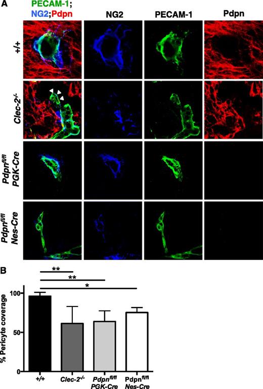 Figure 4. Altered pericyte recruitment to cerebral blood vessels in CLEC-2- and podoplanim-deficient mice. (A) Immunostaining of frozen sections of embryonic heads at E11.5 show pericytes (NG2, blue) adhering to the surface of blood vessels (PECAM-1, green) within the Pdpn (Pdpn, red) expressing neuro-epithelium in wild-type (+/+, includes Pdpnfl/fl littermates; n = 8), Clec-2−/− (n = 3), Pdpnfl/flPGK-Cre (n = 3), and Pdpnfl/flNes-Cre (n = 3) embryos. White arrowheads in Clec-2−/− embryos indicate where blood vessels are distended from the surrounding neuro-epithelium. Scale bars, 10 μm. (B) A reduction in the total number of pericytes in association with blood vessels was observed in Clec-2−/−, Pdpnfl/flPGK-Cre, and Pdpnfl/flNes-Cre embryos. For each n = 1, a minimum of 4 different sections with 8 images per section were analyzed. Statistical significance was measured by a 1-way analysis of variance with a Tukey posttest, where *P < .05 and **P < .01. Error bars show means ± standard error of the mean.