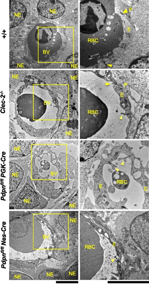 Figure 5. Ultrastructural analysis of Clec-2−/−, Pdpnfl/flPGK-Cre, and Pdpnfl/flNes-Cre microvessels at E11.5 by electron microscopy. In wild-type embryos (+/+, includes Pdpnfl/fl littermates; n = 4), endothelial cells enclose a vascular lumen containing a nucleated fetal erythrocyte and are connected by tight junctions (yellow arrowheads). The endothelium is closely associated with surrounding pericyte foot processes and neuro-epithelial cells. In Clec-2−/− (n = 3), Pdpnfl/flPGK-Cre (n = 4), and Pdpnfl/flNes-Cre (n = 4) microvessels, vascular lumens appear expanded, and their surrounding endothelium is enriched in vacuoles. Inter-endothelial junctions remain tightly closed and secured by endothelial cell flaps (yellow arrowheads). Large gaps between the endothelium and overlying pericytes and neuro-epithelial cells are noticeable. NE, neuro-epithelial cell; BV, blood vessel; RBC, nucleated red blood cell; P, pericyte; E, endothelial cell. Original magnification: (left) ×7500; (right) ×15 000. Scale bar, 5 μm.