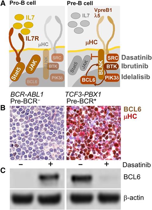 Figure 1. BCL6 as biomarker to identify pre-BCR− and pre-BCR+ cases of human ALL. A schematic summarizing normal cytokine-dependent survival signaling in pro-B cells (pre-BCR−) and pre–BCR-dependent survival signaling in pre-B cells (A). SRC and BTK are targets of dasatinib, BTK is a target of ibrutinib, and PI3Kδ is the target if idelalisib (A), which are being used in clinical trials for patients with mature B-cell lymphoma. Functional assays to measure tonic pre-BCR signaling in ALL patient samples may not be practical for diagnostic purposes. Given that tonic pre-BCR signaling results in strong expression of BCL6,31 immunostainings for BCL6 and immunoglobulin µHC expression represents a feasible alternative to rapidly identify patients that might benefit from treatment with inhibitors of pre-BCR signaling (eg, ibrutinib, idelalisib). (B) Double stainings for BCL6 (brown; D8, Santa Cruz Biotech) and µHC (red; G20-127, BD Biosciences) were performed on paraffin-embedded sections from bone marrow clots. (B) Two patient-derived ALL cases were studied and counterstained with hematoxylin and eosin (100× magnification).66 One pre-BCR− ALL case (BCR-ABL1, left) and 1 pre-BCR+ ALL case (TCF3-PBX1, right) is shown. Panel C shows a western blot analysis of BCL6 expression (D8; Santa Cruz Biotech) in pre-BCR− (left) and pre-BCR+ (right) and ALL cells, with and without treatment with the dual ABL1/SRC-BTK inhibitor dasatinib (25 nmol/L for 24 hours), using β-actin (ab8227, Abcam) as loading control (C).