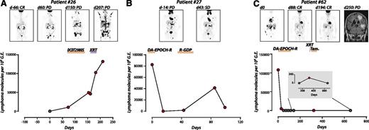 Figure 3. Ig-HTS monitoring of therapeutic response. Time courses of plasma molecular disease during therapy; red, positive molecular disease; black, negative molecular disease. (A) Patient 26 achieved a CR after primary therapy with DA-EPOCH-R for stage IVE DLBCL, but had progression based on a day 60 PET/CT. Plasma molecular disease at this time point was positive. In the ensuing disease progression during several lines of therapy, disease burden can be seen to increase by both plasma molecular disease and PET/CT. (B) Patient 27 was treated for relapsed stage IVAE DLBCL with DA-EPOCH-R with stable disease shown by PET/CT on day 43. Plasma molecular disease decreased, but remained detectable on days 15 and 43. PD was detected by CT on day 77 (data not shown), corresponding with an increased disease burden by plasma molecular disease that again subsides, but remains detectable, following treatment with R-GDP. (C) Patient 62 was diagnosed with stage IVBE DLBCL including leukemic disease, and disease burden can be seen to decline as the patient achieves a CR. An isolated CNS relapse detected by magnetic resonance imaging on day 250 is also detected by Ig-HTS (day 323).