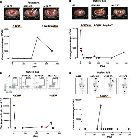Figure 5. Ig-HTS surveillance for disease progression/relapse (A) Patient 41 was treated for stage 1A DLBCL with R-CEOP, achieved a CR, and was monitored thereafter. Plasma ctDNA was positive on day 441 within the plasma, before detection by PET/CT and diagnosis of PD (lead time = 88 days). (B) Patient 46, diagnosed with stage IIA DLBCL, was monitored during treatment encompassing 2 separate relapses. We observed a rapid decline in plasma disease to undetectable levels as this patient achieves a partial response. On days 42 and 84, residual disease was detected by PET/CT (data not shown) despite negative plasma Ig-HTS. A subsequent PET/CT detected progression (day 140) that was also detected by Ig-HTS. The patient achieved a CR by PET/CT after salvage chemotherapy on day 223, but ultimately relapsed as detected by plasma molecular disease on day 473, confirmed by PET/CT on day 487 (lead time = 14 days). (C) Patient 48 was diagnosed with stage IVBE DLBCL with leukemic phase and bone marrow involvement. After treatment with R-CHOP, the patient achieved a CR by flow cytometry on day 228 (data not shown), at which time disease was undetectable Ig-HTS. Plasma molecular disease was detected at a level of 71 860 molecules per million genome equivalents on day 493, despite no evidence of disease on peripheral blood flow cytometry on day 493 or PET/CT (data not shown). Plasma Ig-HTS was positive 162 days before the detection of PD by flow cytometry on day 655. (D) Patient 52 was initially expectantly observed with stage IIIA indolent follicular lymphoma, at which point plasma molecular disease was negative despite clear radiographic evidence. This patient then underwent clinical and histological transformation to DLBCL in a single site that coincided with a dramatic spike in plasma molecular disease. He was treated with R-CHOP chemotherapy for DLBCL, with subsequent CR on PET/CT and normalization of plasma molecular disease.