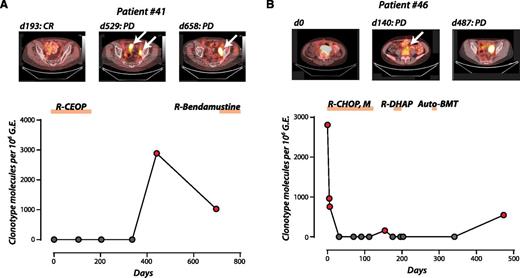 Ig-HTS for disease progression or relapse in DLBCL in 2 patients. (A) A patient treated for limited stage DLBCL achieved a complete response and was shown on monitoring for plasma tumor DNA to have relapse before CT/PET detection of recurrent disease (lead time = 88 days). (B) A patient with 2 separate relapses detected by Ig-HTS coincident with radiologic relapse. Reprinted from Figure 5A-B in the article by Kurtz et al that begins on page 3679.