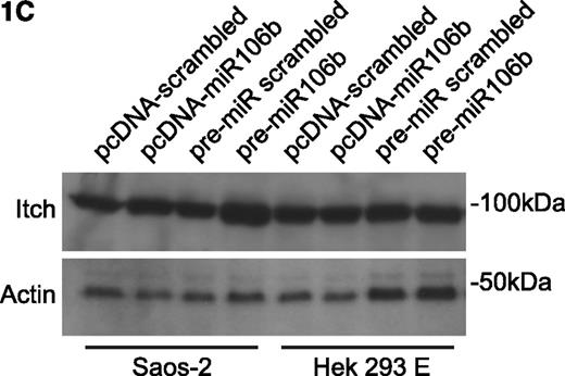 Figure 1. Regulation of Itch in chronic lymphocytic leukemia. (A) Western blotting of expression levels of protein Itch. Primary chronic lymphocytic leukemia (CLL) cells were incubated in presence of 10 nM LBH589 for the indicated times. Levels of actin were used as a loading control. Results from a representative experiment using CLL cells from 1 of the 12 analyzed patients are shown. There is a decrease in the 100 kDa band but with concomitant increase in 64 kDa cleaved product. See also Rossi et al.3 (B) Luciferase reporter assay of miR106b on 3′UTR-Itch in Saos-2 and HEK293 cells. The results were expressed as mean + SD from 3 independent experiments analyzed in triplicate. (C) Western blotting of endogenous levels of protein Itch in Saos-2 and HEK293 cells upon transfection. Cells were transfected either with pcDNA plasmids harboring the mature miR106b or a scrambled sequence, or with pre-miRs for miR106b or a scrambled sequence. Levels of actin were used as a loading control. MiR106b levels were assayed by qRT-PCR, to verify the transfection. (D) Expression levels of TAp73, DNp73, miR34a, and miR106b in primary CLL cells exposed for the indicated times to 10 nM LBH589 as analyzed by qRT-PCR. Expression levels relative to the untreated sample at the corresponding time points are shown. Expression of TAp73 and DNp73 was normalized to actin; expression of miR34a and miR106b was normalized to RNU6b. Statistical differences were determined by one-way analysis of variance (ANOVA) followed by Dunnett multiple comparison test, and the results were expressed as mean ± SEM from 12 independent CLL samples analyzed in triplicate.