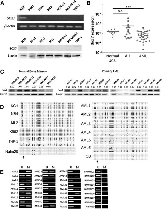 Figure 1. SOX7 expression was downregulated in myeloid malignancies. (A) SOX7 transcript (upper) and protein (lower) were downregulated in AML cell lines (K562, KG-1, ML2, MV4-11, MOLM-13, and THP-1) as compared to Nalm20 (N-20). (B) Expression of SOX7 transcript was measured by quantitative real-time RT-PCR in AML (n = 35), normal UCB CD34+ cells (n = 11), and ALL (n = 13), which was carried out by SYBR Green method in a StepOnePlus thermal cycler (Applied Biosystems, Foster City, CA). SOX7 was significantly downregulated in AML samples. The bars show the mean of expression, and comparisons were evaluated by unpaired Student t test. ***P < 0.001, n.s., not significant. (C) SOX7 protein was more commonly expressed in normal BM samples compared to primary AML samples. (D) Bisulfite sequencing on leukemia cell lines (left). Robust hypermethylation on SOX7 gene was observed in all myeloid leukemia cell lines but not in the precursor B-cell ALL cell line (Nalm20). DNA methylation could also be demonstrated in AML samples 1 to 6 but not in normal UCB CD34+ cells (right). Black dots, white dots, and arrows indicate methylated and unmethylated cytosine in CpG and the position of transcription start site, respectively. (E) DNA methylation of SOX7 in 27 AML and 8 normal BM samples and in the ALL cell line Nalm20 was demonstrated by MS-PCR. M, methylated allele; U, unmethylated allele.