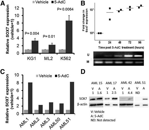 Figure 2. SOX7 expression could be induced by DNA demethylation. (A) SOX7 transcript expression induced by DNA demethylating agent 5-AdC in AML cell lines KG1, ML2, and K562. Cells were treated with vehicle (control) or 5-AdC for 96 hours, and SOX7 expression in vehicle was arbitrarily set as 1. (B) SOX7 expression in KG-1 cells treated with 5-AdC was evaluated every 24 hours by quantitative real-time RT-PCR. SOX7 expression at 0 hours was normalized to 1 (top). Upregulation of SOX7 expression was temporally correlated with its promoter demethylation as shown by MS-PCR (bottom). (C) SOX7 transcript expression induced by 5-AdC in 5 primary AML samples. (D) 5-AdC induced SOX7 protein in 4 primary AML samples. The intensity ratios of SOX7 to β-actin (normalized to the vehicle control) are indicated above the western blot image.