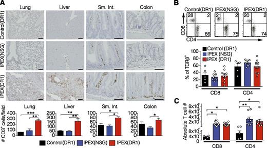Figure 5. Human T-cell inflammation in IPEX(DR1) mice. Immunohistochemical analysis detecting human immune cell infiltration using (A) anti-hCD3 staining on lung, liver, sm. int., and colon tissue sections (top) quantified by counting the number of CD3+ cells/20× field for 3 mice per group (bottom). (B) Representative flow cytometry dot plots of splenic T cells gated on TCR-β+ (left) with the frequency of CD4+/CD8+ T cells reported (right). Open circles are individual mice. (C) The absolute numbers of splenic T cells were quantified. Open circles are individual mice. All values are mean ± SEM. Statistical analysis performed using 1-way ANOVA with Tukey’s multiple comparisons test (A), 1-way ANOVA using Kruskal-Wallis multiple comparisons test (B-C). *P < .05, **P < .01, ***P < .001.