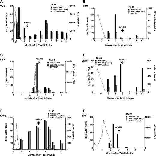 Figure 4. Virus-specific T cells are retained and remain functional after administration of AP1903. Quantification of pathogen-specific T cells detected by IFN-γ ELISPOT in each patient who received AP1903 to control acute GVHD. Patients had viral infection and/or reactivation for: VZV (A, Pt. 6), EBV (B, Pt. 8 and C, Pt. 9), CMV (D, Pt. 8 and E, Pt. 9), BKV (F, Pt. 9). Black histograms represent response from total T cells and striped histograms represent response from endogenous T cells. The value of their difference represents the response from infused iC9-T cells. The gray dashed line indicates the viral load at multiple time points.