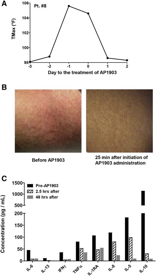Figure 5. Administration of AP1903 rapidly resolves GVHD symptoms and reduces cytokine release. In Pt. 8, (A) the highest body temperature to the time of AP1903 infusion. (B) Pictures of the skin rash were taken prior to and 25 minutes after beginning the AP1903 infusion. (C) Cytokine production in plasma measured from samples collected 4 hours prior to, 2.5 hours after beginning, and 48 hours after the infusion of AP1903.