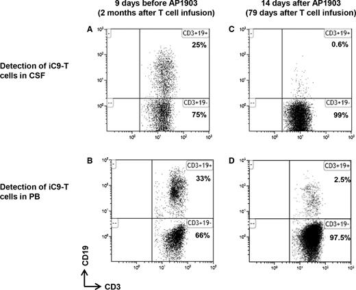 Figure 6. Administration of AP1903 affects iC9-T cells in CSF. Detection of iC9-T cells in CSF and PB by flow cytometry before and after administration of AP1903 (Pt. 6). Nine days before CID treatment in CSF (A) and in PB (B), and 14 days after treatment in CSF (C) and in PB (D). The percentage of CD3+CD19+ T cells and CD3+CD19− T cells was calculated under the gate of CD3+ T cells.