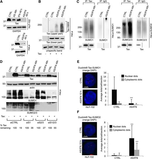 Figure 2. Tax undergoes poly-sumoylation on arsenic/interferon exposure. (A) AS/IFN-induced Tax degradation in (upper) HuT-102 and (lower) Tax-transfected HeLa cells. (B) AS/IFN-induced HMW modifications of Tax (bracket) transiently expressed in HeLa cells. (C) AS/IFN-triggered Tax poly-sumoylation detected by immunoprecipitation of Tax transiently expressed in (left) HeLa-SUMO1 or (right) HeLa-SUMO2 cells followed by western blot using indicated antibodies. IgG, isotypic control antibody. (D) Tax-transfected HeLa cells were cotransfected with control siRNA (siCTRL) or siRNA against SUMO1 (siS1), SUMO2&3 (siS2/3), or SUMO1&2&3 (siS1/2/3). Cells were subsequently treated with AS/IFN for 48 hours. Western blot analysis with indicated antibodies. Densitometric quantification of remaining Tax after treatment is shown. (E) (left) Endogenous Tax-SUMO1 interactions detected by Duolink in AS/IFN-treated (12 hours) HuT-102 cells. Nuclei were stained with 4,6 diamidino-2-phenylindole (DAPI; blue). (Right) Graphs show quantification of nuclear or cytoplasmic Duolink dots, indicative of interaction signals. Averages of 1 Z-section per cell from 30 different cells; significant P values are indicated by asterisks. (F) Endogenous Tax-SUMO2/3 interactions in HuT-102 cells, as in E.