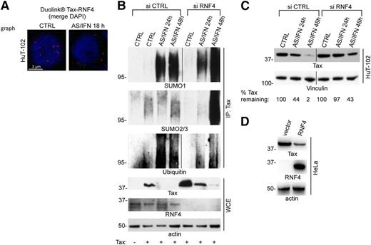 Figure 4. RNF4 degrades poly-sumoylated Tax. (A) Endogenous Tax-RNF4 interactions in untreated or AS/IFN-treated HuT-102 cells as detected by Duolink. Nuclei were stained with DAPI (blue). (B) HeLa cells transiently expressing Tax were cotransfected with siCTRL or siRNA against RNF4 (siRNF4). (Upper) After treatment with AS/IFN for up to 48 hours, cell extracts were immune-precipitated with anti-Tax antibodies, followed by western blot with indicated antibodies. (Lower) Tax, RNF4, and actin are shown in WCE. (C) HuT-102 cells were transfected with siCTRL or siRNF4 and treated with AS/IFN for up to 48 hours. Degradation of endogenous Tax was analyzed by western blot. Vinculin serves as a loading control. Quantification in percentages shows the amount of remaining Tax after normalization. (D) HeLa cells transiently expressing Tax were cotransfected with RNF4. Western blot was performed with indicated antibodies 48 hours after transfection.
