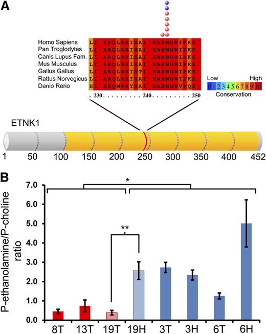Figure 1. ETNK1 mutations in patients with aCML/chronic myelomonocytic leukemia. (A) Outline of the ETNK1 protein. The yellow region highlights the catalytic domain of the protein. The red band corresponds to the mutational hotspot. In the upper part, a conservation analysis of the mutated locus is shown. The red and blue circles highlight the position of individual mutations identified in aCML and chronic myelomonocytic leukemia, respectively. (B) Intracellular phosphoethanolamine/phosphocholine ratio in patients with aCML. The red bars show the intracellular phosphoethanolamine/phosphocholine ratio of leukemic (myeloid) cells in 3 ETNK1 mutated patients (8T, 13T, and 19T, corresponding to patients CMLPh-008, CMLPh-013, and CMLPh-019). The blue bars show the intracellular phosphoethanolamine/phosphocholine ratio of myeloid (3T, 6T) or lymphoid (3H, 6H) cells negative for ETNK1 mutations (patients CMLPh-003 and CMLPh-006). The light red and light blue bars indicate the intracellular phosphoethanolamine/phosphocholine ratio of a matched myeloid/lymphoid sample whose leukemic (myeloid) cells are positive for ETNK1 mutation. The error bars represent the standard deviation of 3 experiments. The asterisks indicate the significance level: *P < .05; **P < .005.