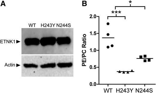 Figure 2. Phosphoethanolamine/phosphocholine ratio in a TF1-ETNK1 cellular model. (A) Western blot anti-ETNK1 showing the intracellular level of ETNK1 protein in TF1-WT, N244S, and H243Y. (B) Intracellular phosphoethanolamine/phosphocholine ratio as assessed by HPLC–mass Spectrometry in TF1 cells transduced with ETNK1-WT, N244S, and H243Y.