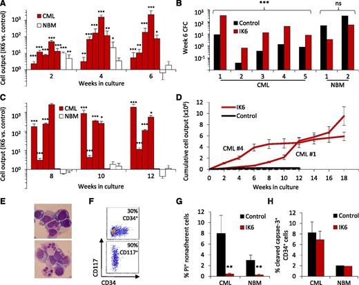 Figure 3. IK6 consistently expands primitive CP-CML cell numbers more than normal cells in vitro. (A) Total mature (nonadherent) cells present in 2-, 4-, and 6-week-old cultures initiated with CD34+ cells (5-10 × 103 each, depending on the experiment) from 5 CP-CML patients and 2 normal BM samples according to the design shown in Figure 1A. Values are the mean ± SEM of the ratios of the number of test (GFP+) vs control (YFP+) cells measured in 4 replicates for each sample. P values: IK6 vs control. (B) Numbers of CFCs present after 6 weeks in the individual cultures shown in panel A, as enumerated in a 14-day methylcellulose assay and expressed as CFCs per 103 starting cells. (C) Total nonadherent cells in secondary 6-week cultures (each initiated with one primary culture equivalent). Cells from CP-CML patient #5 showed no growth in secondary cultures. Values are as in panel A. (D) Cumulative cell outputs in serial primary, secondary, and tertiary cultures initiated with cells from CP-CML patients #1 and #4. Cells from CML patients #2 and #3 showed no further growth in tertiary cultures. Values shown are the mean ± SEM. (E) Representative cytospin preparations of nonadherent cells present in tertiary cultures generated from CP-CML #1 (top) and #4 (bottom). (F) Representative flow cytometry plots corresponding to panel E showing analysis of nonadherent cells present in tertiary cultures generated from CP-CML #1 (top) and #4 (bottom). (G) Proportion of apoptotic (PI+) IK6- and control-derived CP-CML and normal BM nonadherent cells from 2- to 3-week-old cultures. Values shown are the mean ± SEM from 3 replicate cultures for each of the experiments shown in panel A. P values: IK6 vs control. (H) Proportion of apoptotic (cleaved caspase 3+) IK6- and control-derived CP-CML and normal BM CD34+ cells in 2- to 3-week-old cultures. Values shown are the mean ± SEM (as indicated) of results for 3 replicate cultures from 4 CP-CML samples and 1 normal BM sample. *P < .05; **P < .01; ***P < .001. NBM, normal bone marrow.