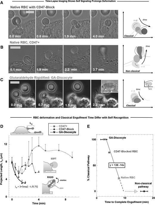 Figure 2. Phagocytic uptake of opsonized RBCs is faster with CD47 inhibition but fastest for rigid RBCs. Human-derived THP-1 macrophages were incubated with human RBCs that were opsonized with anti-hRBC antiserum and also (A) blocked with anti-CD47, (B) native RBCs with active CD47+, or (C) rigidified as GA discocytes. Time-lapse imaging in DIC and phase contrast begins with initial adhesion between macrophage and RBC targets and ends on complete engulfment (scale bar, 8 μm). At the right of each time-lapse series, silhouettes of the target RBC clarify the changes in RBC morphology over the course of engulfment and RBC position relative to the macrophage boundaries, as indicated by the sketched lines (C, fourth panel, inset) GA discocytes are often enclosed in a spacious phagosome that shows gaps between the discocyte and phagosome membranes. (D) The projected length (Lp) of the engulfed RBC was quantified along the phagocytosis axis (schematic, top left) and shows that phagocytic deformation is fast and classically vectored inward for rigid RBCs and for CD47-blocked RBCs compared with native RBCs (n ≥ 3 ± SD). When CD47 can signal self, phagocytosis is much slower, and Lp often increases (up to 1.5-fold Lp0). (E) The percentage of classical uptake events for each RBC treatment is plotted vs the time required to complete engulfment, with the frequency of classical uptake showing a negative linear correlation with engulfment time (line fit, R2 = 1.0). Nonclassical uptake is most frequently observed with native RBCs that signal self and deviates from the classical trend by at least twofold.