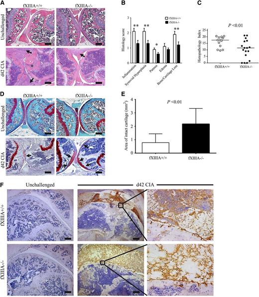 Figure 2. Elimination of fXIIIA results in diminished CIA joint pathology and destruction. (A) Representative hematoxylin and eosin–stained knee joint sections from unchallenged and CIA-challenged fXIIIA+/+ and fXIIIA−/− cohorts. Upon CIA challenge, significant inflammation, synovial hyperplasia (arrows), and erosive pannus (asterisk) are apparent in fXIIIA+/+ mice, whereas knee joints of fXIIIA−/− mice display markedly attenuated pathological features. (B) Semiquantitative microscopic analysis knee joint pathological features from fXIIIA+/+ (n = 13, white bars) and fXIIIA−/− (n = 17, black bars) male mice. Student t test. (C) Scatter plot of composite histopathology index analysis (see Methods) of hematoxylin and eosin–stained knee joint sections. Each symbol represents the composite score for individual mice and bars denote median values for each genotype. (D) Representative safranin-O stained knee joint sections from unchallenged and CIA-challenged fXIIIA+/+ and fXIIIA−/− mice. (E) Quantification of area of intact/preserved articular cartilage per knee based on safranin-O stain. Data are mean ± standard error of the mean with n = 5 mice per genotype and analyzed using Student t test. (F) Representative images of immunohistochemical fibrin(ogen) staining within the knee joints of (left) unchallenged and (middle and right) CIA-challenged mice. Bars represent 200 µm. *P < .05; **P < .01 (B).