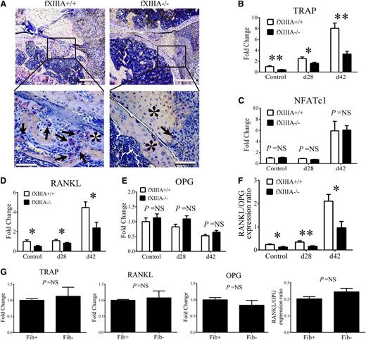Figure 5. Impaired osteoclast differentiation/activation within the joints of fXIIIA-deficient mice. (A) Representative images of knee joint sections harvested from CIA-challenged fXIIIA+/+ and fXIIIA−/− mice stained for TRAP. Note numerous TRAP+, multinucleated osteoclasts (arrows) within erosive lesions of fXIIIA+/+ knee joints, but largely absent in sections from fXIII−/− mice. The * indicates area of intact bone. Quantitative RT-PCR analysis mRNA for (B) TRAP gene expression, (C) NFATc1, (D) RANKL gene expression, and (E) OPG gene expression within hind paw joints harvested from unchallenged and CIA-challenged fXIIIA+/+ and fXIIIA−/− mice. Data are expressed as average fold change relative to unchallenged fXIIIA+/+ group. (F) Ratio of RANKL and OPG relative expression. (G) Quantitative RT-PCR analysis of local mRNA levels of TRAP, RANKL, OPG, and the ratio of RANKL/OPG in the hind paws of unchallenged Fib+ and Fib− mice (n = 6 per genotype). All data are expressed as mean ± standard error of the mean. Data were analyzed by 2-way analysis of variance followed by Student-Newman-Keuls posthoc test in which *P < .05; **P < .01. NS = not significant (B-G). Scale bar represents 200 μm (top panels) and 10 μm (bottom panels) (A).