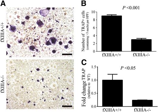 Figure 6. FXIIIA deficiency results in significantly reduced osteoclastogenesis in vitro. (A) Representative images of TRAP staining of splenocyte cultures harvested from fXIIIA+/+ and fXIIIA−/− mice and cultured in the presence of 30 ng/mL monocyte colony stimulating factor (M-CSF) and 100 ng/mL RANKL for 8 days. Note the presence of numerous large, multinucleated, TRAP+ (purple) osteoclasts in fXIIIA+/+ cultures, whereas fXIIIA−/− splenocyte cultures produced visibly fewer TRAP+/multinucleated cells. (B) Quantification of osteoclast number in 10 random high-powered fields per culture from each of 3 mice. TRAP+ cells that contained >3 nuclei were counted as osteoclasts. Data are represented as mean ± standard error of the mean. (C) Quantitative RT-PCR analysis of TRAP gene expression in osteoclast cultures (n = 3 mice per genotype). Data are expressed as average fold change over wild-type with error bars denoting standard error of the mean. Data were analyzed by the Student t test.