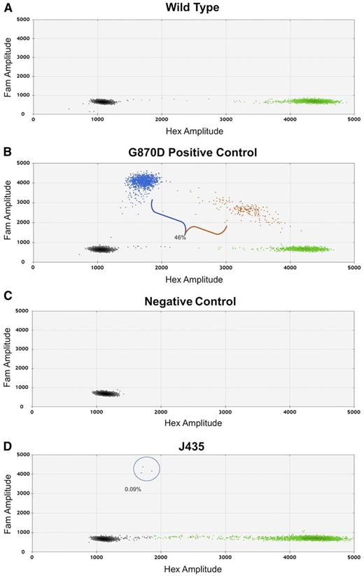 Figure 2. Representative ddPCR experiment. (A) Wild-type DNA reveals only HEX-positive droplets. (B) Positive control DNA from a patient with a SETBP1 p.G870D mutation reveals a mixed population of HEX- and FAM-positive droplets. Orange droplets indicate the presence of mutant and wild-type DNA within 1 droplet. (C) When no DNA is added, no template control wells contain only empty droplets. No HEX- or FAM-positive droplets are identified. (D) DNA from sample J435 reveals the presence of subclonal SETBP1 p.G870D mutations in 3 droplets, representing an allelic fraction of 0.09%.