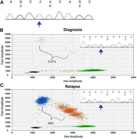 Figure 3. Confirmation of subclonal SETBP1. (A) Mutant droplets were sorted, collected, and lysed for DNA. A Sanger tracing of sorted mutant droplet DNA from diagnosis revealed the SETBP1 c.2608G>A (p.D868N) mutation. (B) ddPCR at diagnosis using pooled bone marrow–derived DNA from the same patient showed a subclonal mutation at diagnosis not detected by Sanger sequencing. FAM (blue) droplets indicate the presence of mutant SETBP1 DNA; HEX (green) droplets indicate the presence of wild-type DNA; orange droplets indicate the presence of both mutant and wild-type DNA. (C) At relapse, a clonal SETBP1 mutation is clearly visible on ddPCR and Sanger sequencing. Percentages indicate the allelic fraction of mutant SETBP1.