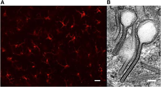 Langerin expression and Birbeck granules are hallmarks of Langerhans cells. (A) Conventional fluorescence microscopy of an epidermal sheet prepared from healthy human skin. Langerhans cells are immunolabeled with anti-CD207/langerin monoclonal antibody (Miltenyi Biotec). Scale bar, 30 µm. (B) Detail from a transmission electron micrograph of a human epidermal Langerhans cell in situ featuring 2 tennis racket–shaped Birbeck granules. Scale bar, 60 nm.