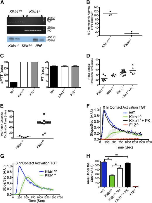 Figure 1. Characterization of Klkb1−/− mice. (A, top) An agarose gel from a polymerase chain reaction showing genotype of WT control (Klkb1+/+) and Klkb1−/−; (bottom) immunoblots for prekallikrein antigen in murine Klkb1+/+ and Klkb1−/− plasmas and normal human plasma (NHP). Both murine and human plasmas were added at 2 different concentrations (see Materials and methods). (B) Plasma kallikrein activity from Klkb1+/+ and Klkb1−/− mice after activation of PK as determined by cleavage of chromogenic substrate HD-Pro-Phe-Arg-pNA. The data are presented as percentage of pooled normal murine plasma KK activity. Three individual mice plasmas were examined in each genotype. (C) aPTT (left 3 columns) and PT (right 3 columns) were determined in WT, Klkb1−/−, and F12−/− plasmas (n = 4 in each group). The absence of the line on the top of 2 aPTT bar graphs indicates that they were >200 seconds. (D) Carotid artery occlusion times on the rose bengal thrombosis model. Klkb1+/+, Klkb1+/−, Klkb1−/−, and Klkb1−/− mice reconstituted with purified human plasma prekallikrein to make the blood 450 nM were examined in this assay. Five to 12 animals were examined in each group. (E) Carotid artery occlusion times on the ferric chloride thrombosis model. (F-G) Contact activation–induced thrombin generation times (TGT) in WT (Klkb1+/+), Klkb1−/−, Klkb1−/− + 450 nM human prekallikrein, or F12−/− plasma without incubation (F) or after incubation for 3 hours at room temperature (G) (n = 4 in each group). The slopes of the TGT are relative values normalized to WT. (H) The AUCs were calculated and quantified from the TGT curves in (F). Data were normalized to the WT value for each set of experiments.