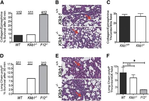 Figure 2. Role of contact activation in thrombosis protection in Klkb1−/−. (A,D) Survival rate in WT, Klkb1−/−, and F12−/− mice after challenge with collagen/epinephrine (Col/Epi) (A) or long-chain bacterial polyphosphate (LC polyP) (D). The ratios on top of each column represent the number of mice surviving 30 minutes. (B,E) Hematoxylin and eosin (H&E) staining of lung sections from Col/Epi- (B) or LC polyp- (E) challenged Klkb1+/+ and Klkb1−/− mice. The red arrows point to representative occluded vessels. Images were obtained from a Leica SCN 400 Slide Scanner equipped with a Hamamatsu line-sensor color camera and a ×40/0.65 objective lens. The images were made through a ×2 tube lens at ×40 final magnification. (C) (Col/Epi) and (F) (LC polyP). Number of vessel occlusions quantified from H&E staining. Vessel occlusions per visual field were counted at ×40. Mean ± standard error of the mean (SEM) of 100 fields per group are shown. *Significant difference (P < .05) among the groups on 1-way analysis of variance (ANOVA).