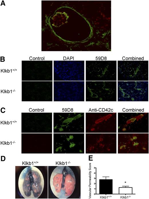 Figure 3. Demonstration of vessel fibrin, platelets, and permeability after contact activation injury to the lung. (A) Immunofluorescence of a large vessel with an internal fibrin rim using Mab 59D8 (green) and platelet thrombus using anti-CD42c (red) with a fibrin border after Col/Epi-induced pulmonary embolism. (B) Immunofluorescence of microvessel thrombi for fibrin after Col/Epi pulmonary embolism. (C) Immunofluorescence of colocalization of fibrin and platelets in microvessel thrombi after Col/Epi pulmonary embolism. (A-C) Images were obtained on a Nikon Eclipse TE2000-S microscope at ×10 magnification. (D) Representative whole-lung Evans blue dye permeability in Klkb1+/+ and Klkb1−/− tissue. The images were taken with an iPhone 5 through a ×2 objective of a Nikon C-W 10XB/22 dissecting microscope. (E) Vascular permeability score for Evans blue dye in Klkb1+/+ (n = 5) and Klkb1−/− (n = 4) lungs (P < .036).