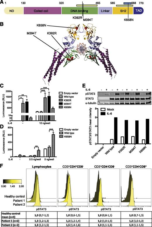 Figure 2. STAT3 mutations K658N, K392R, and M394T in studied patients. (A) Schematic representation of STAT3 protein domains with the observed mutations marked as black lines. Germ-line and somatic mutation hotspots for HIES5,6 and LGL leukemia11-13 are indicated as green and blue bars, respectively, at top. (B) Crystallographic structure of STAT3 dimer (RCSB Protein Data Bank code 1BG1). K658N, K392R, and M394T mutations are indicated as red dots. (C-D) HEK293 cells containing STAT3-responsive luciferase were transfected with empty, WT, and mutant STAT3 overexpression plasmids with or without IL-6 stimulation. K392R and M394T significantly increased STAT3 transcriptional activity in basal and stimulated conditions. Error bars represent standard error of the mean (n = 6; C). The K658N mutant showed hypersensitivity to IL-6 stimulation in low concentrations. Error bars represent standard error of the mean (n = 3; D). Two-way analysis of variance, *P < .05, **P < .01, and ***P < .001. (E) No significant increase in pSTAT3Y705 phosphorylation was observed when HEK293 cells were transfected with mutant STAT3-overexpression constructs. Equal amounts of parallel-derived whole cell lysates were loaded per condition. α-tubulin and STAT3 were used as loading and expression controls, respectively. +, presence of IL-6 stimulation; –, absence of IL-6 stimulation. (F) In peripheral blood, no significant increase in STAT3 phosphorylation was noted in studied patients. Color change indicates relative pSTAT3Y705 expression. Forward panel, K392R; middle panel, K658N; back panel, healthy control (n = 3, value range presented in parentheses).