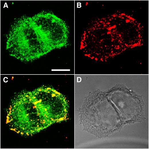 Figure 3. HGAL colocalizes in cellular membrane with lipid raft proteins. Confocal and differential interference contrast images of HGAL-GFP-expressing MCF7 cells that were cross-linked by cholera toxin B. Maximum-intensity images were generated from a series of 30 stack images acquired at a thickness of 0.5 μm. (A) HGAL channel. (B) Cholera toxin B channel. (C) Cholera toxin B overlaid on HGAL. (D) Differential interference contrast image. Results are representative of 2 independent experiments. Bar = 10 μm.