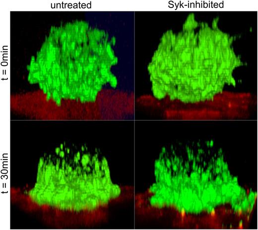 Figure 4. HGAL relocalizes to BCR interaction membrane regions after binding to anti-IgM. U2932 cells stably expressing HGAL-GFP were pretreated with dimethylsulfoxide (control; “untreated”) or Syk inhibitor (20 nM, BAY61-3606; “Syk-inhibited”) for 30 minutes and then seeded on 8-well slides (ibidi, Verona, WI) coated with phycoerythrin-conjugated anti-human IgM F(ab′)2. Cells were fixed at 0 and 30 minutes with 3.5% paraformaldehyde and used for images as described in the “Materials and methods” section. No attachment with membrane spreading was observed on non–anti-human anti-IgM F(ab′)2-coated slides. Ig, immumoglobulin.