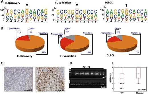 Figure 3. C/G predominance of BCL2 mutations and AID expression in FL. (A) Depiction of bp preference of mutations in the FL discovery (left), FL validation (middle), and DLBCL (right) cohorts. The size of letters corresponds to the frequency with which that nucleotide is mutated in the BCL2 coding strand. (B) Transition and transversion load in FL discovery, FL validation, and DLBCL cohorts. Within each group, transitions are depicted in orange, transversions in red, and other changes in gray. (C) Images of FL validation cohort lymph node biopsies from diagnosis showing low (left) and high (right) staining after reaction with anti-AID primary antibody and peroxidase-labeled secondary antibodies. (D) RT-PCR was performed in 21 FL patient samples to detect AID expression differences at the mRNA level. Actin was used as an RNA loading control. (E) AID score (calculated as described in “Methods”) from 128 pretreatment FL validation cohort diagnostic samples depicted as a function of BCL2 mutation status (P < .0001).