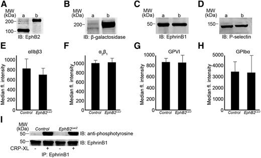Figure 1. Characterization of EphB2LacZ platelets. The presence of EphB2 (A), β-galactosidase (B), and ephrinB1 (C) was confirmed in control (a) and EphB2LacZ (b) mouse platelets by immunoblot analysis. Similarly, the expression level of P-selectin was measured in control (a) and EphB2LacZ (b) mouse platelets by immunoblot analysis (D). The expression levels of αIIbβ3 (E), α2β1 (F), GPVI (G), and GPIbα (H) were analyzed on control and EphB2LacZ platelets by flow cytometry. Data represent mean (of median fluorescence intensity) ± SD (n = 4, control and EphB2LacZ mice). (I) ephrinB1 was immunoprecipitated from control and EphB2LacZ platelets following stimulation with CRP-XL (0.5 µg/mL) and analyzed for its phosphorylation using anti-phosphotyrosine antibody by immunoblotting. The blots are representative of 3 separate experiments. CRP-XL, cross-linked collagen-related peptide; GP, glycoprotein; SD, standard deviation.