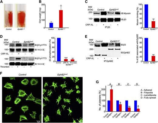 Figure 5. Integrin αIIbβ3-mediated outside-in signaling is reduced in EphB2LacZ platelets. (A) The effect of deletion of EphB2 intracellular domains in clot retraction was analyzed using PRP from control and EphB2LacZ mice for 2 hours. (B) Clot weight measured after 2 hours. Data represent mean ± SD (n = 3). (C) Integrin β3 was immunoprecipitated from resting and CRP-XL (0.5 µg/mL)–stimulated control and EphB2LacZ platelets and analyzed for its association with myosin by immunoblot analysis. (D) Phosphorylation of integrin β3 in resting and CRP-XL (0.5 µg/mL)– or thrombin (0.1 U/mL)–activated control and EphB2LacZ platelets was analyzed using phospho-specific integrin β3 antibody for pY773. The protein 14-3-3ζ was analyzed as a protein loading control by immunoblot analysis. (E) β3 integrin was coimmunoprecipitated with EphB2 in control and EphB2LacZ platelets, and analyzed for its association by immunoblot. Immunoblots shown are representative of 3 separate experiments. Data represent mean ± SD (n = 3) and the level of phosphorylation obtained in the control (activated) samples was taken as 100%. (F) Washed platelets obtained from control and EphB2LacZ mice were allowed to spread on fibrinogen-coated cover glass for 45 minutes prior to staining with Alexa Fluor 488 phalloidin and analyzed by confocal microscopy. Images are representative of 3 separate experiments. (G) Multiple images obtained by differential interference contrast microscopy were analyzed by counting numbers of platelets in various stages of spreading using Image J software. P values shown are as calculated by Student t test: *P ≤ .05, **P ≤ .01, and ***P ≤ .001. PRP, platelet-rich plasma.
