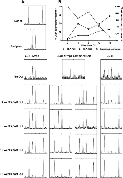Figure 7. Expansion of donor-derived CMV-specific T cells after donor lymphocyte infusion. (A) Conversion to donor chimerism was associated with massive expansion of donor-derived CMV-specific T cells in the weeks after DLI. (B) Serial chimerism analyses demonstrating the shift to donor chimerism within the different T-cell compartments. Taken together, the results demonstrate effective priming and expansion of a primary immune response from the virus-naive donor.