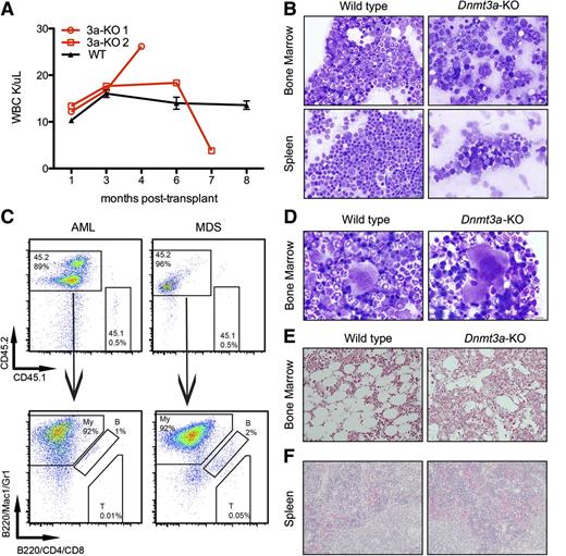 Figure 3. Mice transplanted with Dnmt3a-KO HSCs develop myeloid malignancies. (A) WBC counts of 2 mice transplanted with Dnmt3a-KO HSCs and 3 representative mice transplanted with WT HSCs. Error bars represent mean ± SEM. (B) Wright-Giemsa staining of bone marrow and spleen touch preps from a mouse transplanted with WT HSCs and a mouse transplanted with Dnmt3a-KO HSCs diagnosed with AML. (C) Immunophenotyping confirms donor-derived cells (CD45.2) in the bone marrow express myeloid markers (Mac1/Gr1). My, myeloid; B, B-cells; T, T-cells. (D) Wright-Giemsa–stained bone marrow touch preps from a mouse transplanted with WT HSCs and from a mouse transplanted with Dnmt3a-KO HSCs that was diagnosed with MDS; shown is a dysplastic binucleated megakaryocyte with coarse granules in the cytosol in the MDS mouse. (E) Reticulin staining of a bone marrow section from a mouse transplanted with WT HSCs, and from a mouse transplanted with Dnmt3a-KO HSCs, with black fibers indicative of fibrosis. (F) Hematoxylin and eosin staining of spleen sections from the 2 mice diagnosed with PMF demonstrating extramedullary hematopoiesis. Bars represent 20 μm (B,E-F) and 10 μm (D).