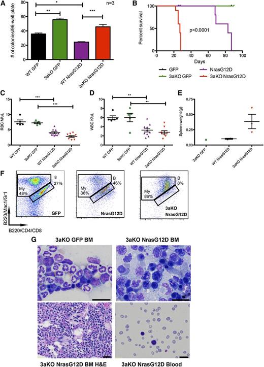 Figure 4. Lack of Dnmt3a accelerates Nras driven malignancy. (A) Number of colonies per plate after single green fluorescent protein (GFP)-positive stem and progenitor cells were sorted into individual wells of 96-well plates (N = 3 plates per genotype/transduction). Representative of 2 independent experiments. (B) Kaplan-Meier survival curve of mice transplanted with WT HSCs transduced with MSCV-IRES-GFP (n = 7) or MSCV-NrasG12D-IRES-GFP (n = 10) and mice transplanted with Dnmt3a-KO HSCs transduced with MSCV-IRES-GFP (n = 7) or MSCV-NrasG12D-IRES-GFP (n = 10) (median survival of WT-NrasG12D mice: 83 days; KO-NrasG12D: 27 days; P < .0001). Representative of 2 independent experiments. Red blood cell (RBC) counts (C) and WBC counts (D) 3 weeks after transplant of WT or Dnmt3a-KO HSCs transduced with GFP or NrasG12D (n = 10 mice for each genotype transplanted with NrasG12D; n = 7 mice for each genotype transplanted with GFP). (E) Spleen weights of mice sacrificed at 10 weeks posttransplant. Error bars represent mean ± SEM. (F) Immunophenotyping of bone marrow from mice transplanted with WT HSCs transduced with MSCV-IRES-GFP or MSCV-NrasG12D-IRES-GFP and Dnmt3a-KO HSCs transduced with MSCV-IRES-GFP, stained for myeloid (My) and B cells (indicated with letter B). Parent gate is live; CD45.2+GFP+. (G) Wright-Giemsa staining of bone marrow (BM) touch preps showing dysplastic erythroid precursors with irregular nuclear contours and peripheral blood smears, and a hematoxylin and eosin (H&E)-stained bone marrow section showing dysplastic megakaryocytes with bizarre-shaped nuclei from mice transplanted with Dnmt3a-KO HSCs transduced with MSCV-IRES-GFP or MSCV-NrasG12D-IRES-GFP. Bars represent 20 μm. *P < .05, **P < .01, ***P < .001.